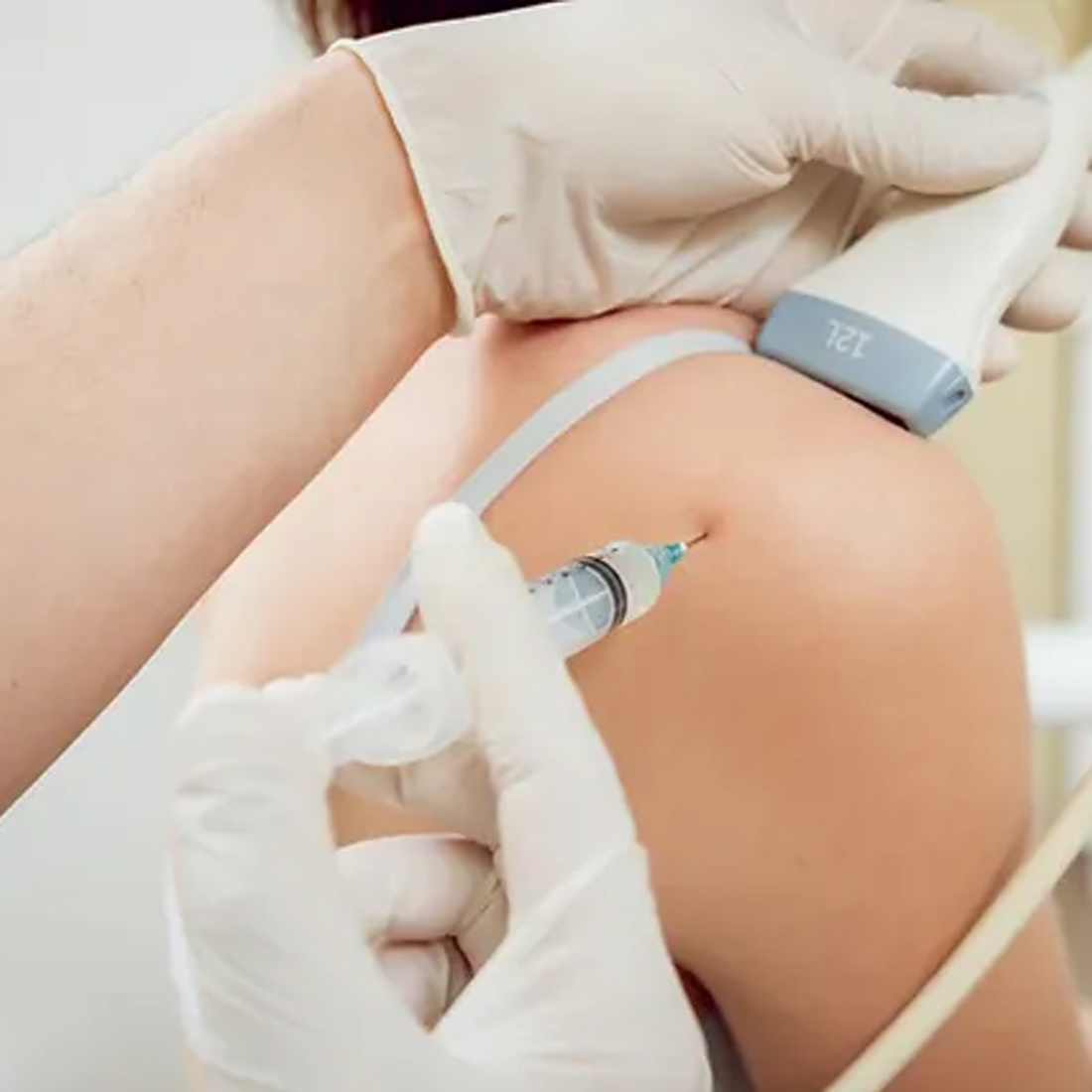 Guided Injection in Luton